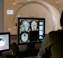 Stock photo of a computer screen showing a brain MRI