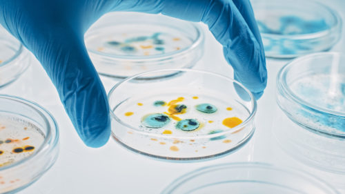 Scientist Works with Petri Dishes with Various Bacteria, Tissue and ...