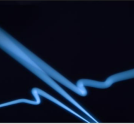 Closeup of a hospital pulse monitor wave